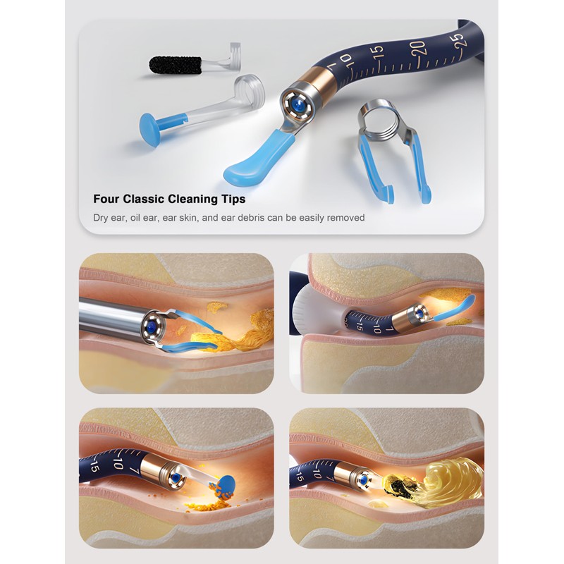 BEBIRD Earsight Plus Ear Wax Removal Tool Camera with HD