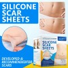 Parche De Silicona Reutilizable Cicatrices Rollo (4.5cmx3m)