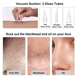 【3-IN-1】Microdermabrasion Machine, mcwdoit 0-68cmHg Strong Suction Power, Professional Dermabrasion Facial Skin Care