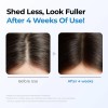 Sérum Para Crecimiento De Cabello Y Cuero Cabelludo 20ml