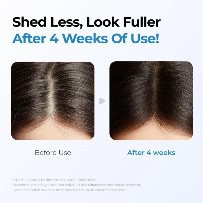 Sérum Para Crecimiento De Cabello Y Cuero Cabelludo 20ml