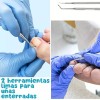 Universo en Linea Kit Corrección Uñas Encarnadas Pie Herramienta Pedicura