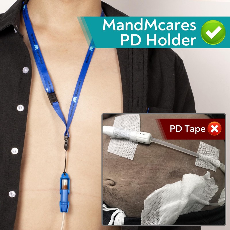 Smaller Peritoneal Dialysis Catheter Transfer Set Holder. PD Secure Shower