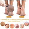 Foot File, Callus File, Pumice Stone Exfoliating Pedicure, Rasp Foot