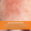 La Roche Posay Anthelios KA+ SPF50+ 50ml