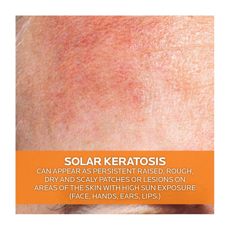 La Roche Posay Anthelios KA+ SPF50+ 50ml