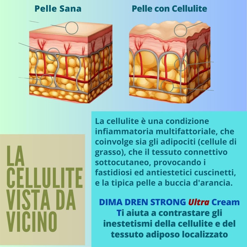 Dima Dren Strong Anti-Cellulite-Creme, starke Entwässerung, hyperpenetrante, bioaktive Formel, straffend