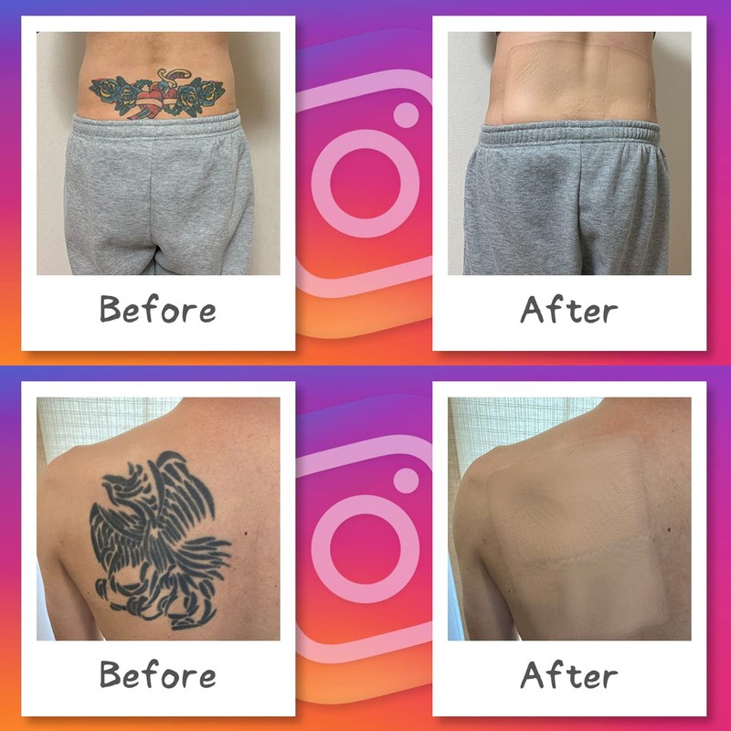 Foundation Tape (Tattoo Concealment Stickers, Hide Tattoos) Extra Large Size,