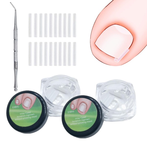 101 Pcs Ingrown Toenail Treatment Set, Clear Ingrown Toenail Corrector