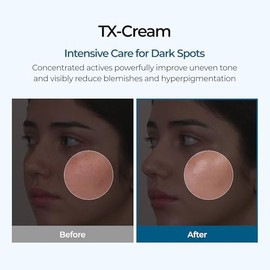 DR. Melaxin TX Ácido Tranexámico CREMA | Crema para pecas en la piel, manchas, anti-pigmentación cuidado de la piel coreana | Cosméticos coreanos | 1.
