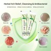 KoKoWill 4 Pcs Natural Chinese Herbal Eczema Cream for Itching