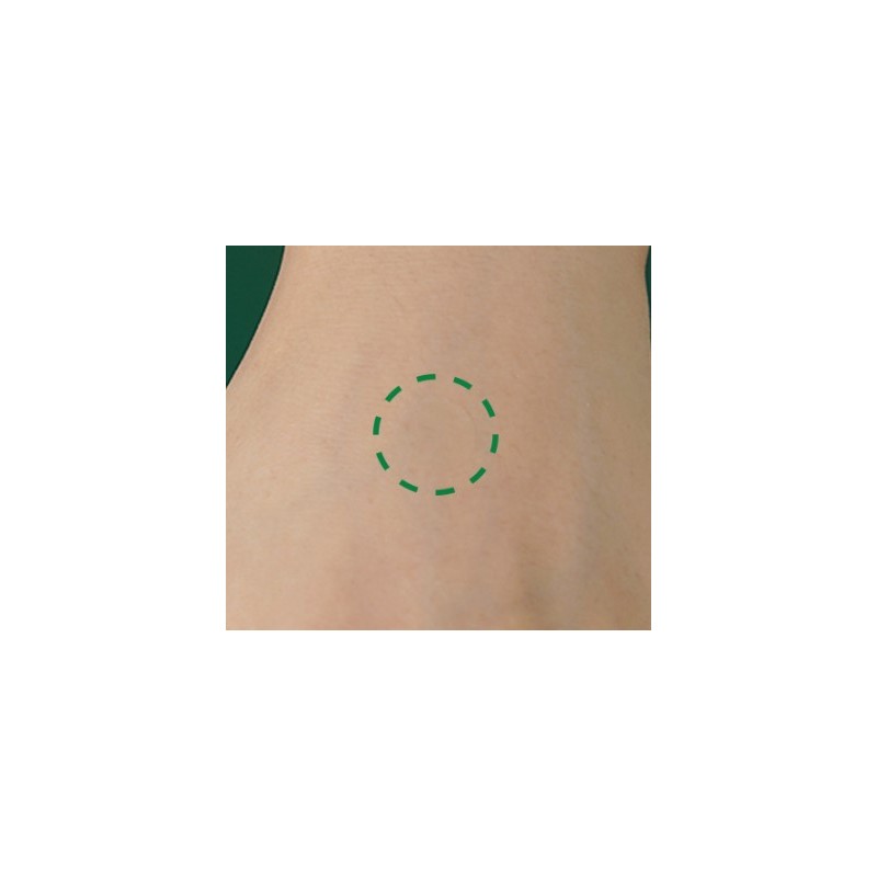 큐어시스 어성초 아크페어 스팟패치, 90개입, 2개 Cureusis Mugwort Acne Spot
