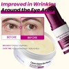 Set Hidratante Contorno De Ojos Parches 60 Pzs + Bálsamo