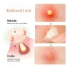 Parches Antiacné Absorbentes y Calmantes, Aplanan Imperfecciones