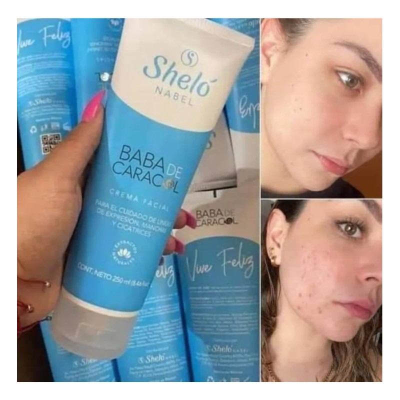 Kit Cuidado Facial Vitamina C - Shelónabel Skincare + Regalo