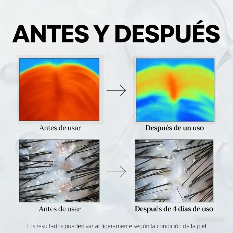 Ampolla Para El Cuidado Del Tratamiento Crecimiento Cabello