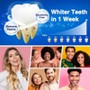Whitening Strips Bleaching Teeth Stripes: MrDoggy Whitening Stripes, Teeth Whitening
