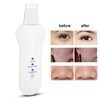 Ultrasonic Skin Scrubber Blackhead Acne Removal Face Skin Deep Cleansing