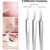 Blackhead Remover Comedone Extractor,15 Pcs Professional Stainless Steel Blackhead Remover
