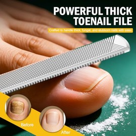 FVION Toenail File for Thick Nails and Toenail Lifter, 2pcs Stainless Steel Nail File and Ingrown Relief Set, Heavy Duty Metal Emery Board for Seniors, Men & Women Pedicure Tool (Green)