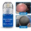 Copper Peptide Hair Growth Serum for Plumper & Denser Hair