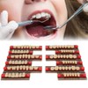 Resin Tooth Acrylic Resin Denture Teeth Dental Resin False Teeth