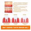 generic 14 Piezas De Gel Dental Para Restauración