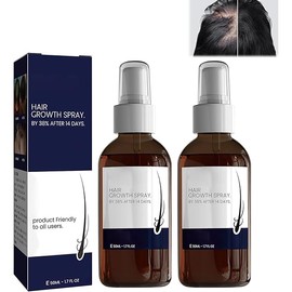Ouhoe Hair Growth Spray and Serum - Natural Hair Regrowth Oil for Men and Women, Enhancing Hair Growth, Hair Growth Serum (2PCS)