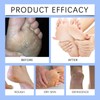 60% Urea Cream - Cracked Heel Repair Cream For Feet