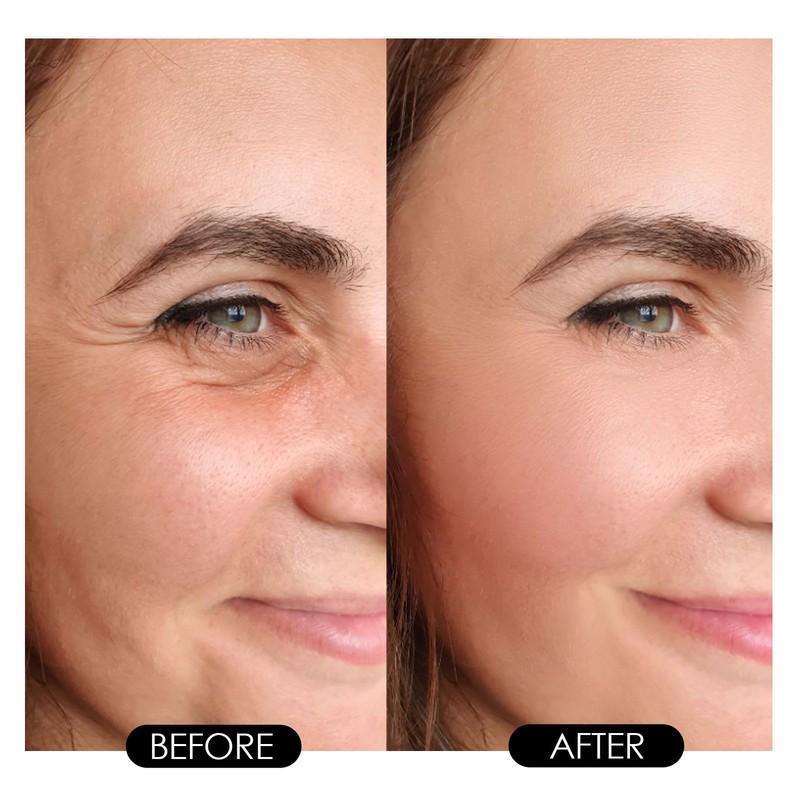 2pcs 30ml Retinoid Serum Minimizes Fine Lines Firming Anti Wrinkle