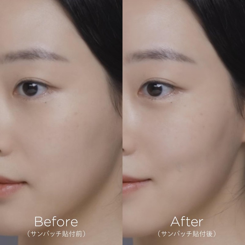 XNUDIE サンパッチクリア 5シート（10パッチ） 透明 99％ UVブロック シミ取り 後のケアに ナイアシンアミド配合 紫外線対策とスキンケアを同時実現