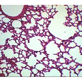 EISCO Lung Section, Prepared Microscope Slide - 75 x 25mm - Anatomy, Biology & Microscopy