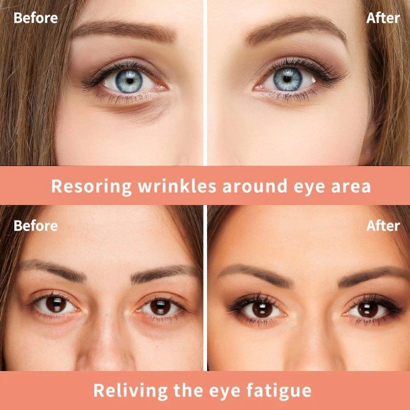 2PCS Instant Remove Dark Circles Wrinkles Face Lines Puffy Eyes