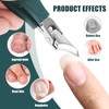 3pcs Ingrown Toenail Clippers Set, Professional Beveled Eagle Beak Nail
