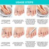 Ingrown Toenails Set Toenail Correction Patch Corrector Pedicure Stainless Steel