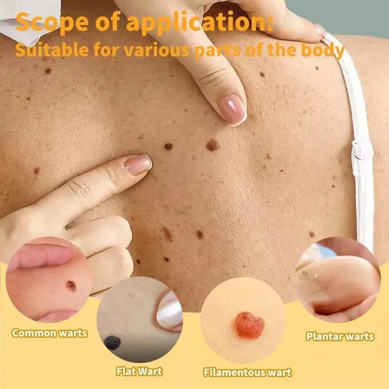 Crema For El Tratamiento De La Piel Dp 2 Piezas