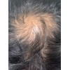 Shampo Sólido Artesanal, Natural Anticaída De Cabello