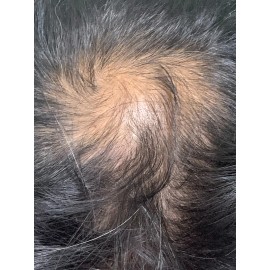 Shampo Sólido Artesanal, Natural Anticaída De Cabello