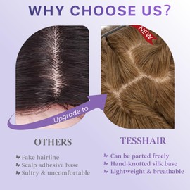 TESSHAIR Human Hair Topper with Bangs, 100% Remy Toppers Hair Pieces for Women, No Tangle & Smooth, Clip on Bangs 14 Inch #04 Medium Brown