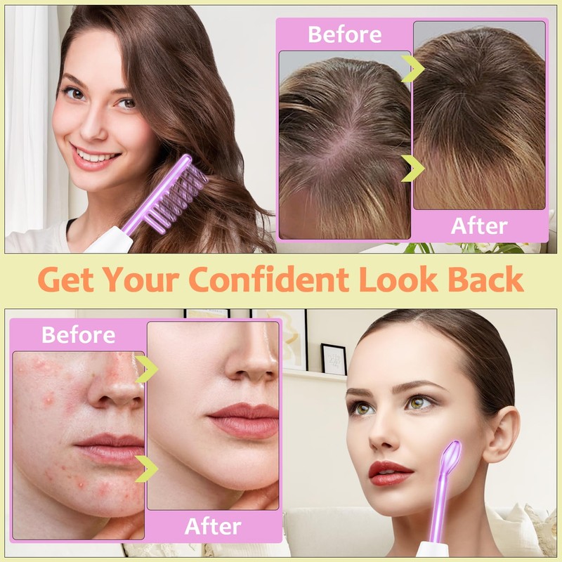High Frequency Facial Wand - Uaike 4 in 1 Violet