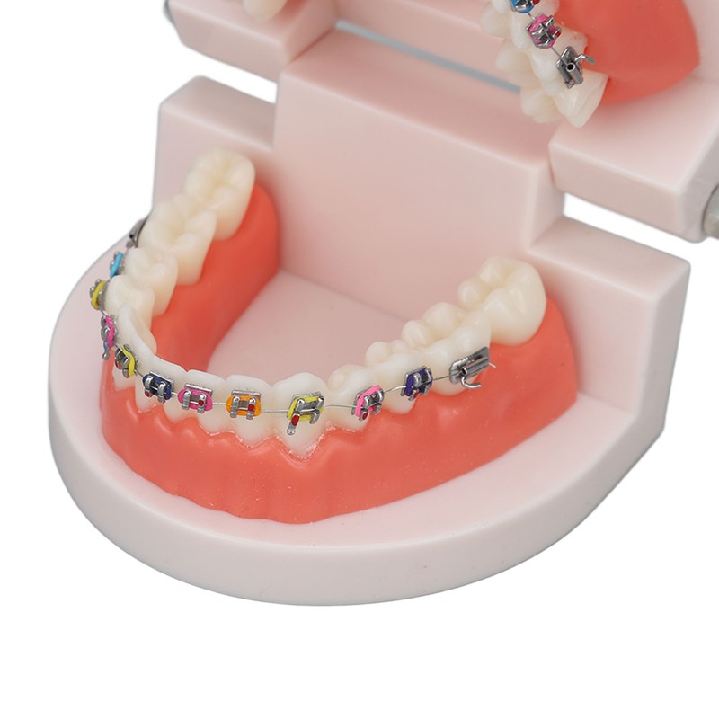Dental Typodont Teeth Model with Orthodontic Metal Bracket for Dentist