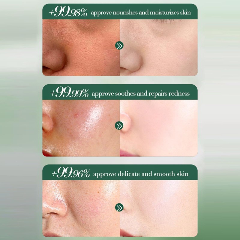 Centella Moisturizer Cream, 60 G Soothing Centella Calming Gel Cream