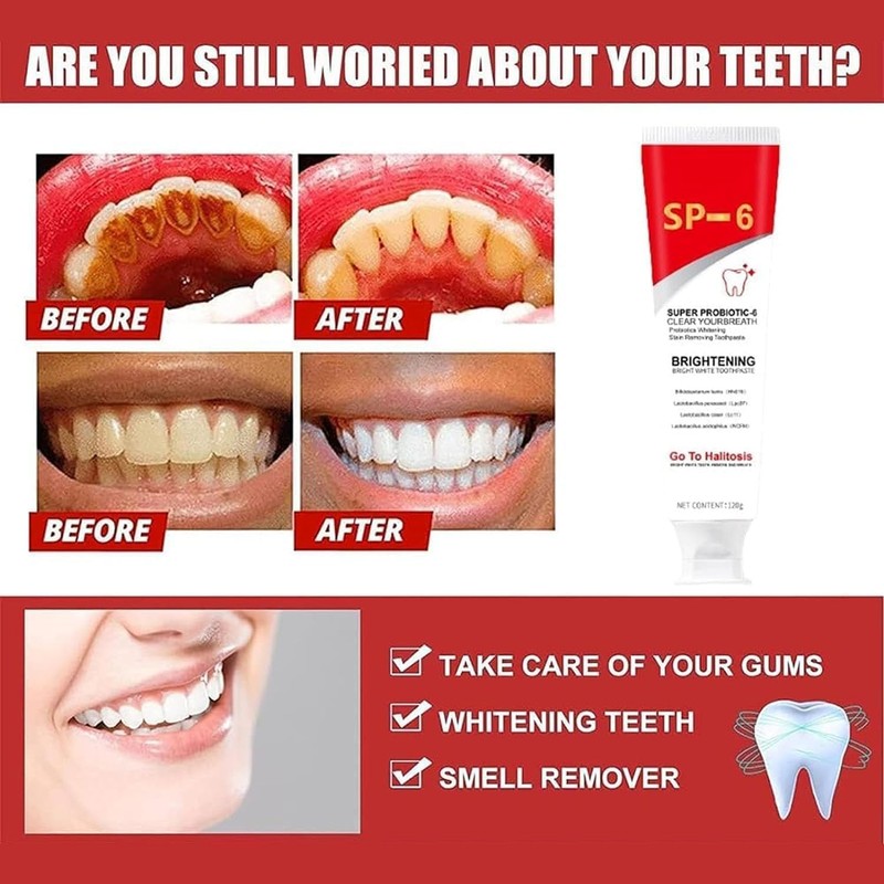 SP-6 Ultra Whitening Toothpaste, Toothpaste Sp-6 Brightening, Probiotics Bright White