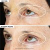 Strivectin Tighten & Lift Peptight - Suero Para Ojos De