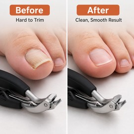 Heavy-Duty Nail Clippers for Thick Nails – Stainless Steel Cutter with Catcher for Clean Grooming