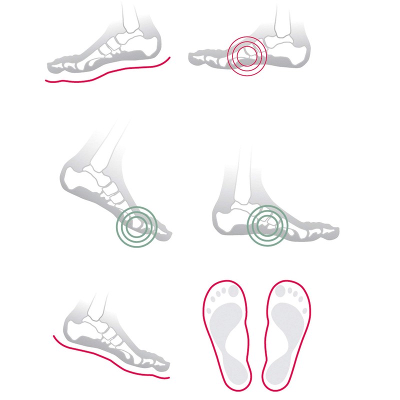 Cork Fan Orthopaedic Insoles Pair - Prevents Hallux Valgus Discomfort