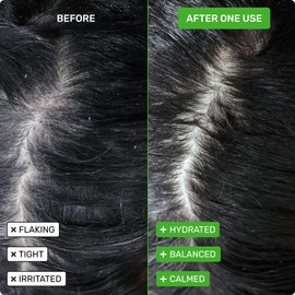 Ethique Scalp Health Shampoo Bar for itchy, dry, flaky scalps