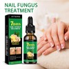 Jaysuing Ginger Nail Care Solution Repair Nails Soft Nail Shine
