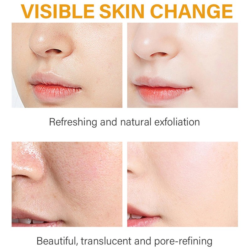 Turmeric Kojic Acid Serum, Natural Skin Lightener for Even Complexion,