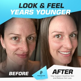 Collagen Powder for Women Men (5Lb) Types I & III Unflavored Easy to Mix Hydrolyzed Protein Peptides Non-GMO Grass-Fed Gluten-Free Kosher Pareve Healthy Hair Skin Joints and Nails